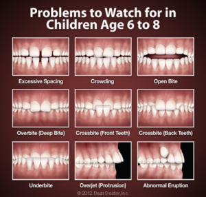 Potential Teeth Problems